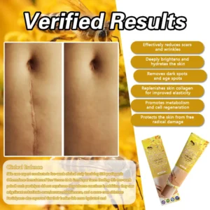 DOCTIA™ Bee Venom Medical Grade Scar Remove Advanced Gel