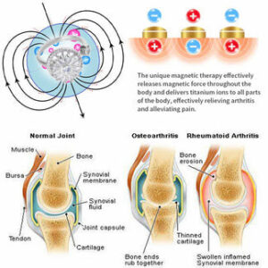 Futusly™ Lymphatic Magnetic Detox Spinning Ring