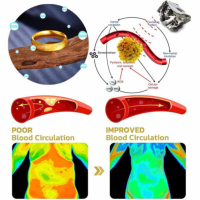 Futusly™ – Cat’s Eye Ring for Lymphatic Magnetic Therapy