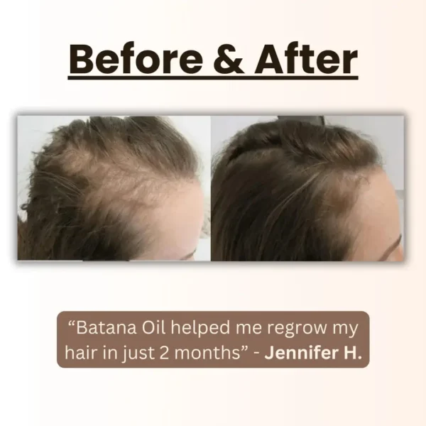 Natural Herbal Handcrafted Batana Oil Hair Growth Blend 4.2OZ