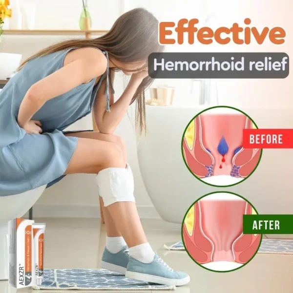 AEXZR™ Hemorrhoid & Fissure Cream