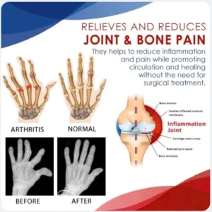 AEXZR™ Joint & Bone Therapy Foam