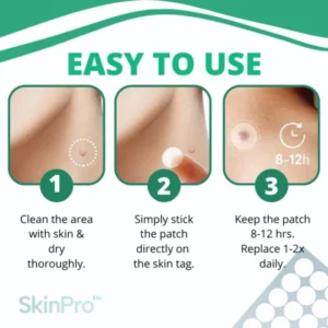 AEXZR™ Skin Tag Remover Patch