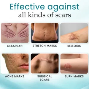 EdiJonah™ Advance Scar Care Formula