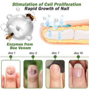 FLYCARE™ Nail Fungus Treatment Serum