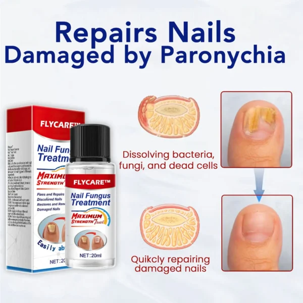 FLYCARE™ Nail Fungus Treatment Serum