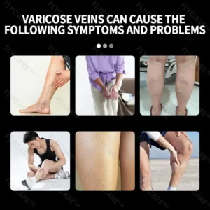 FLYCARE™ Varicose Veins Spray