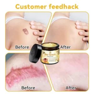 Furzero™ Bee Venom Skin Treatment Cream