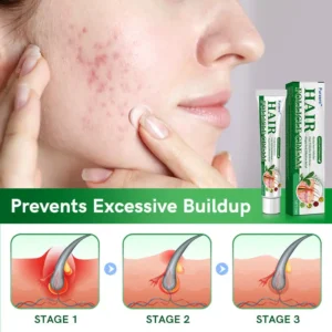 Furzero™ Follicle Acne Purify Cream