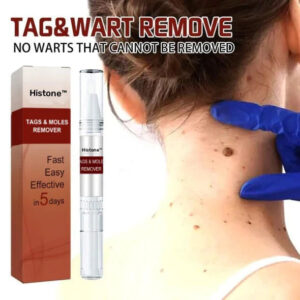 Histone™ Tags & Moles Remover