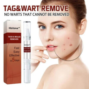 Histone™ Tags & Moles Remover