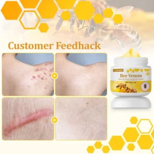 LOVILDS™ TagCure Bee Venom Wart & Moles Removal Cream