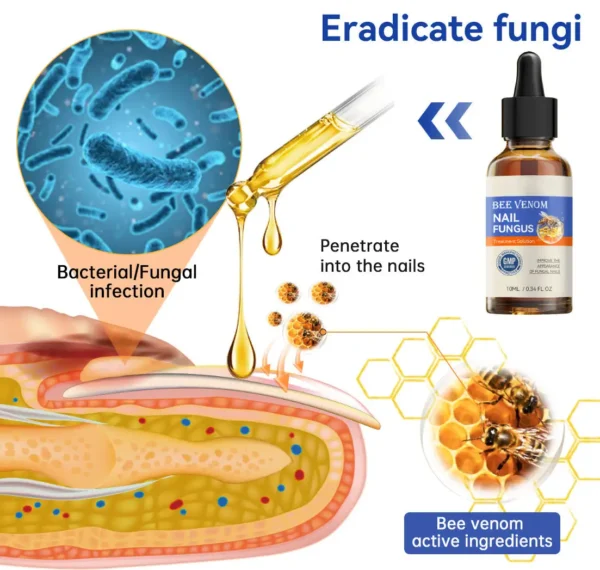 Lotmay® Bee Venom Nail Fungus Treatment Solution