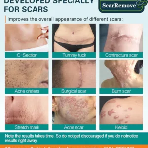 ScarRemove For All Types of Scars