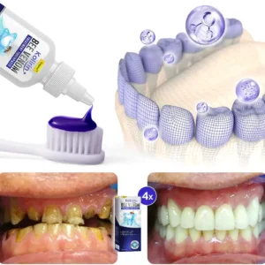 UNPREE™ Kolirin Bee Venom Treatment Toothpaste