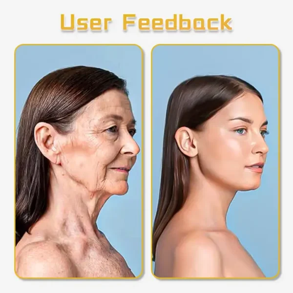 UltraRenew Ultrasonic Facelift Device