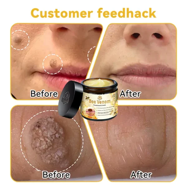 flysmus™ Bee Venom Skin Treatment Cream