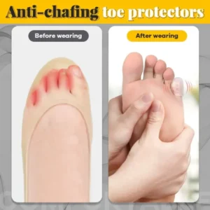 AEXZR™ Silicone Anti-Friction Toe Protector