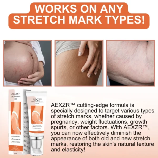 AEXZR™ Stretchmarks Removal Cream