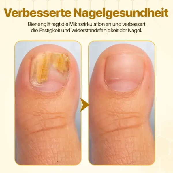 Biancat™ BeeVenom Nagelrestaurierungsserum