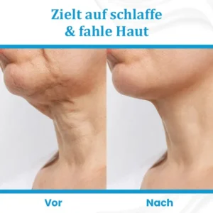 Ceoerty™ EternaLIFT Ultra Straffende Hautcreme