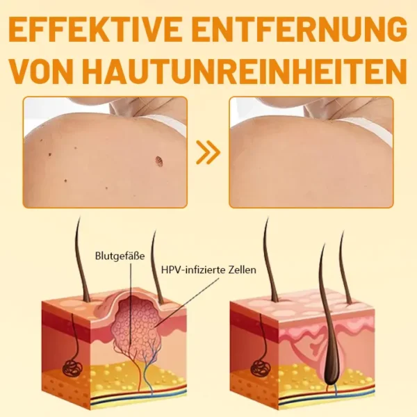 Ceoerty™ VenomErase Hauterneuerungscreme