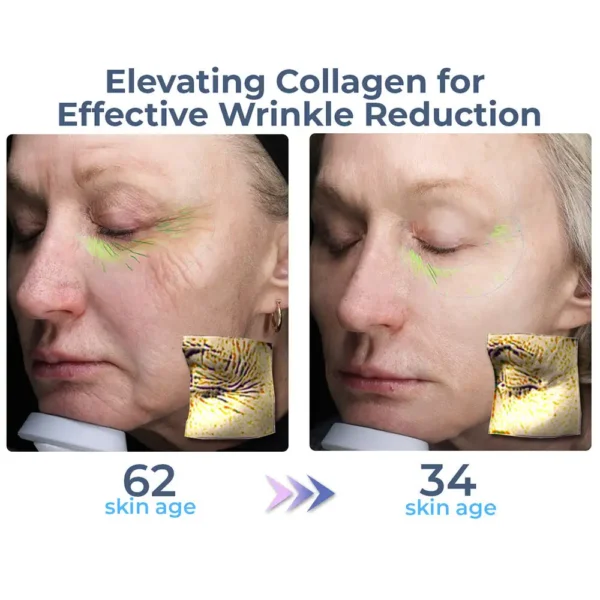 Collagen Advanced Complete Eye Cream