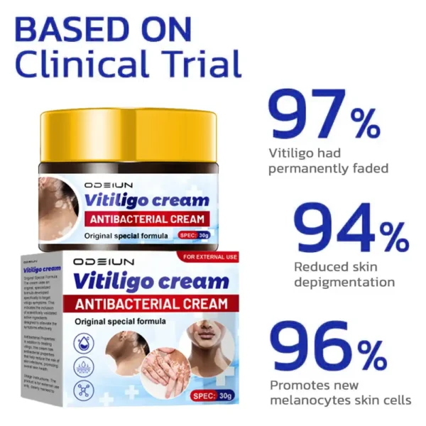 ODEIUN™ BeeVenom Vitiligo Treatment Cream