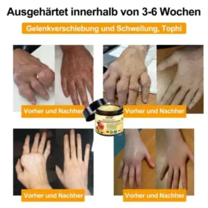 AEXZR™ Bienengift-Schmerzlinderungs Knochenheilungs Creme