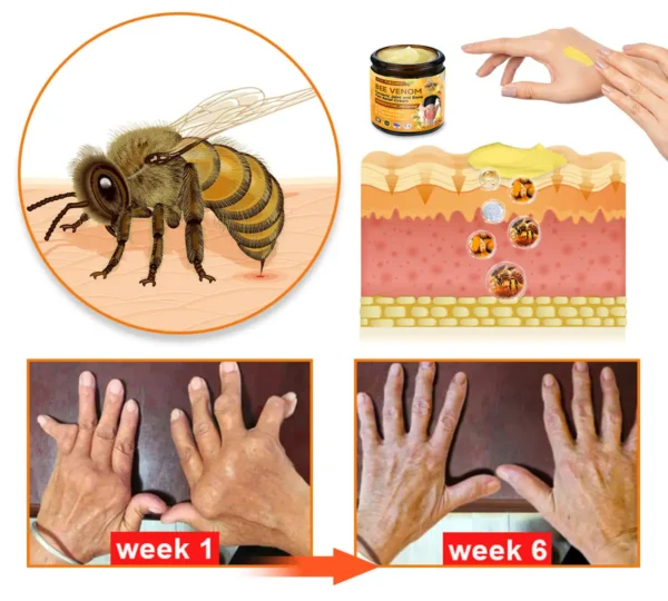 Croaie™ Bee Venom & Turmeric Joint and Bone Pain Relief Cream