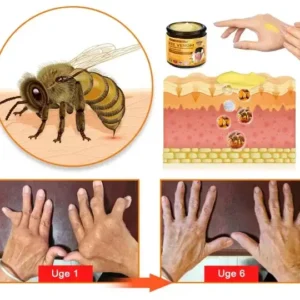 HONXI™ Bee Venom & Gurkemeje-creme til lindring af led-og knoglesmerter