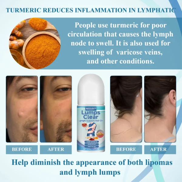 Lovilds™ LumpsClear Lymph Say Goodbye to Lipomas and Swelling