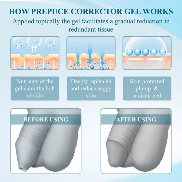 MaleGuard™ Redundant PrepuceCorrector Gel