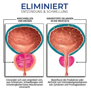 Oveallgo™ BeeProsta BIO-ACTIVE Nasenspray für die Prostatagesundheit