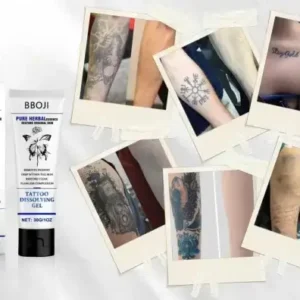 Tattoo Removal Cream - Fast Painless & Scar-Free Tattoo Erasure