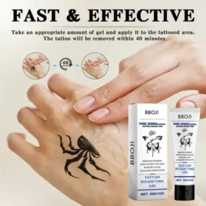 Tattoo Removal Cream - Fast Painless & Scar-Free Tattoo Erasure